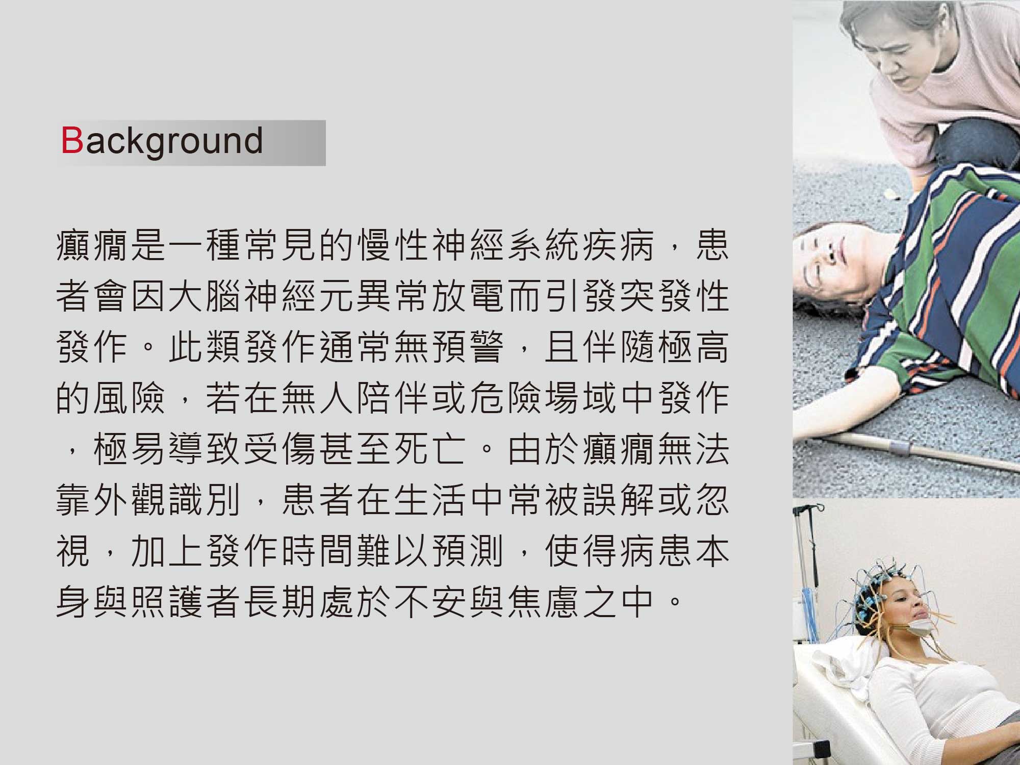 癲癇智慧型腦波監測