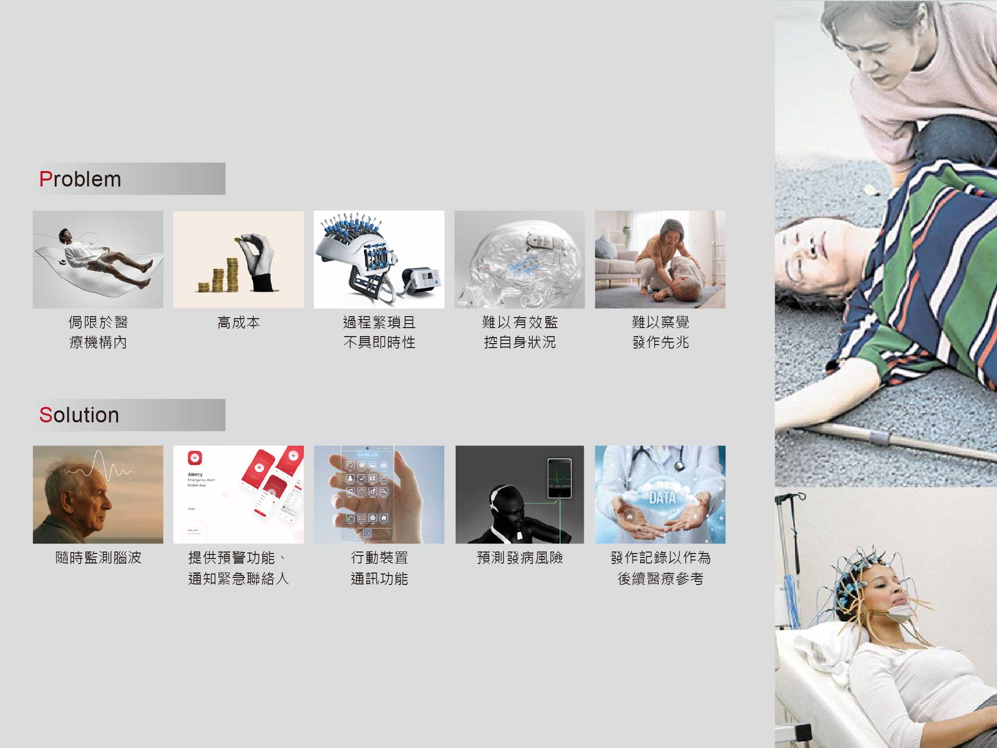 癲癇智慧型腦波監測